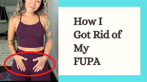 FUPA: Fatty Upper Pubic Areas